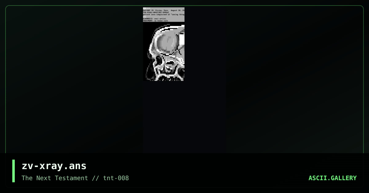zv-xray.ans, by zerovision, 2004